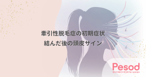 牽引性脱毛症の初期症状とサイン｜結んだ後の頭皮の痛みや赤みは要注意