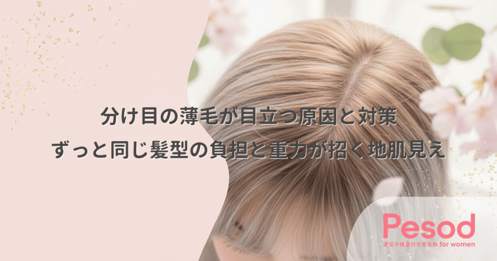 分け目の薄毛が目立つ原因と対策｜ずっと同じ髪型の負担と重力が招く地肌見え
