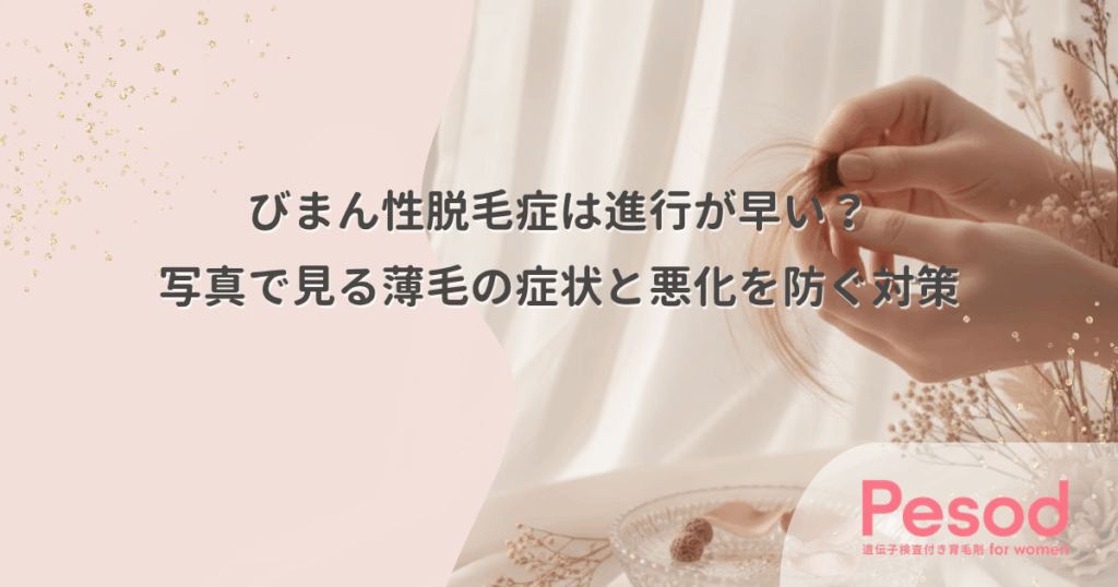 びまん性脱毛症は進行が早い？写真で見る薄毛の症状と悪化を防ぐ対策