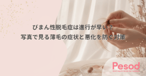 びまん性脱毛症は進行が早い？写真で見る薄毛の症状と悪化を防ぐ対策