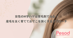 女性のM字ハゲは育毛剤で治る？産毛を太く育てておでこを狭くするアプローチ