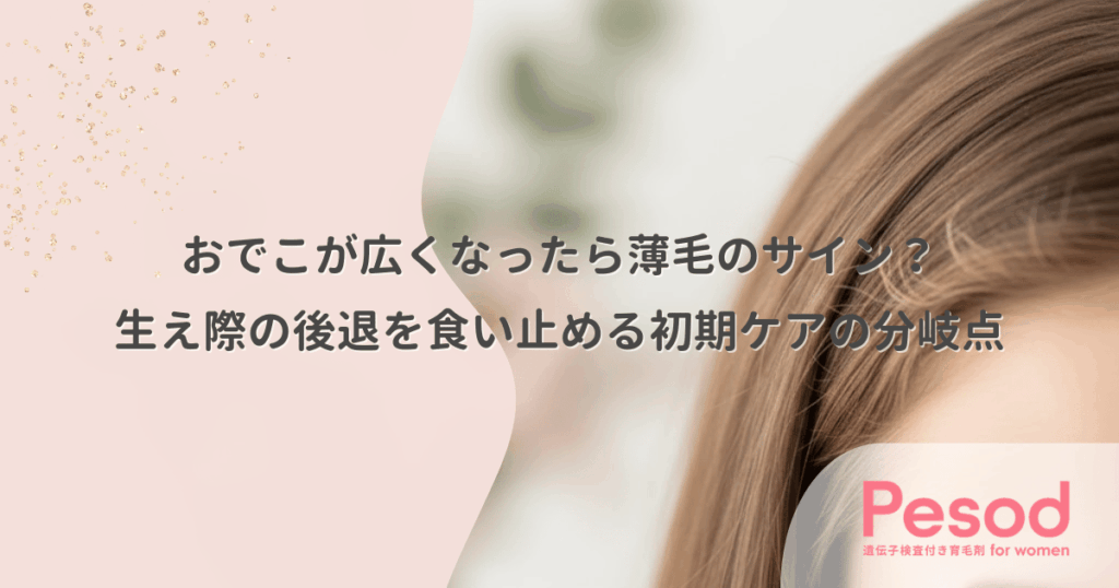 おでこが広くなったら薄毛のサイン？生え際の後退を食い止める初期ケアの分岐点