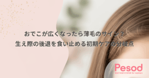 おでこが広くなったら薄毛のサイン？生え際の後退を食い止める初期ケアの分岐点