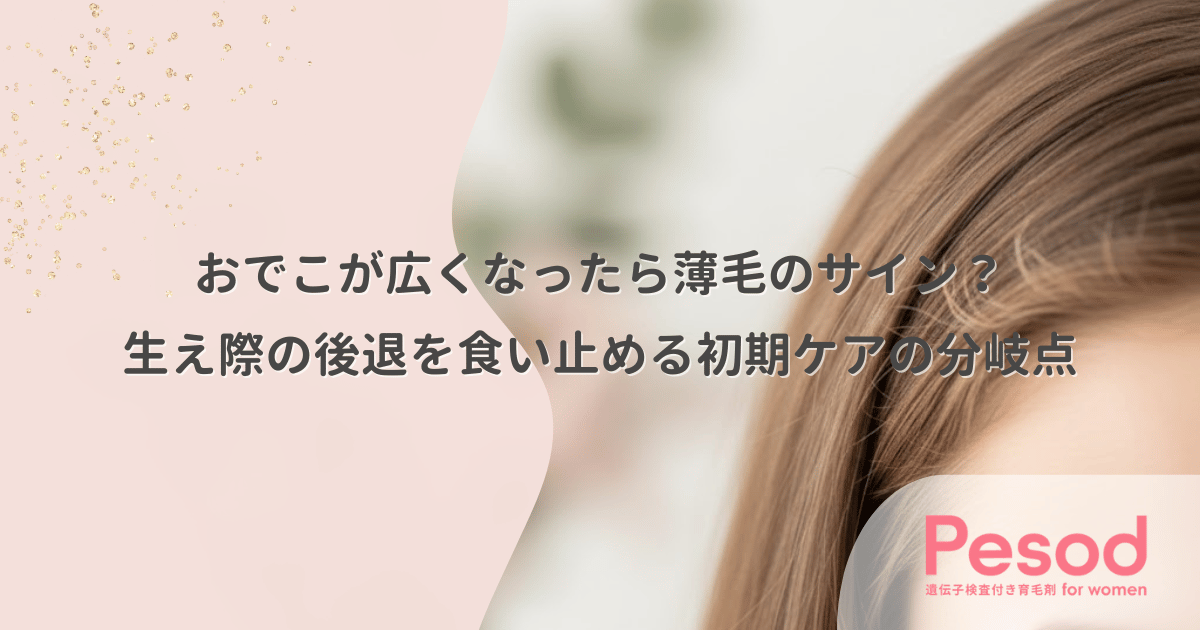 おでこが広くなったら薄毛のサイン？生え際の後退を食い止める初期ケアの分岐点