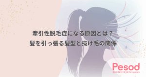 牽引性脱毛症になる原因とは？髪を引っ張る髪型と抜け毛の関係