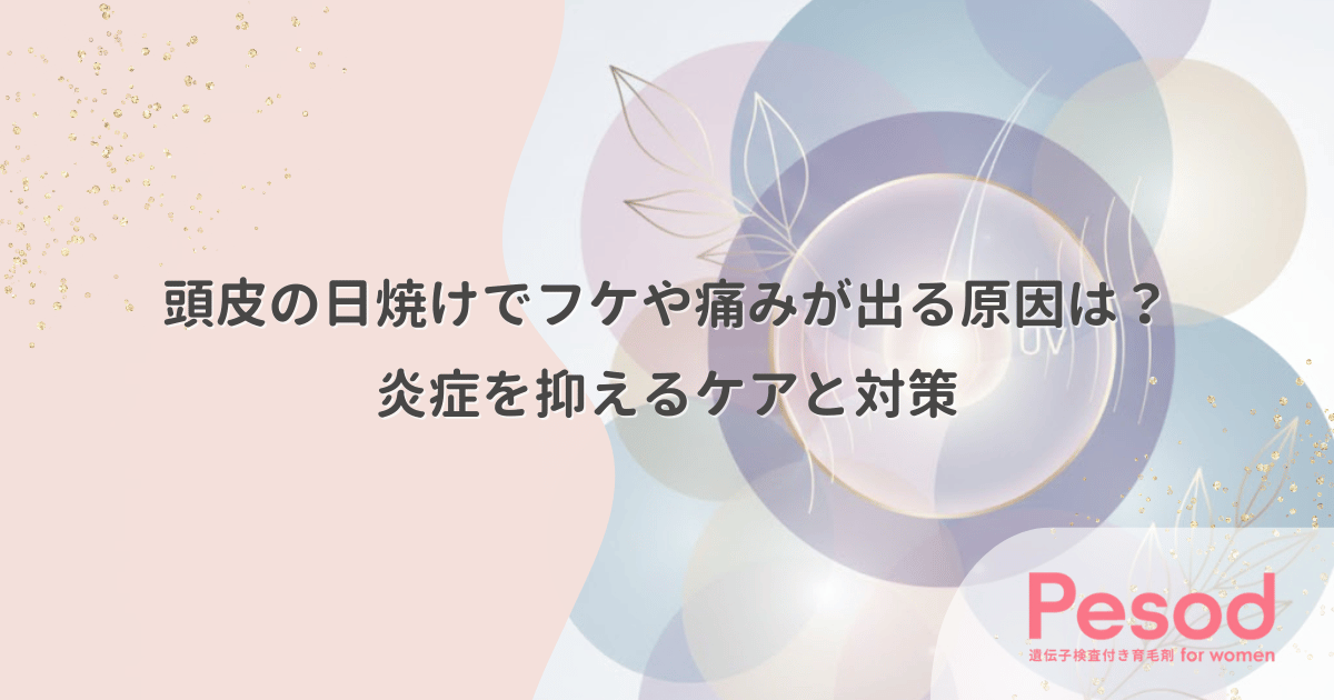 頭皮の日焼けでフケや痛みが出る原因は？炎症を抑えるケアと対策
