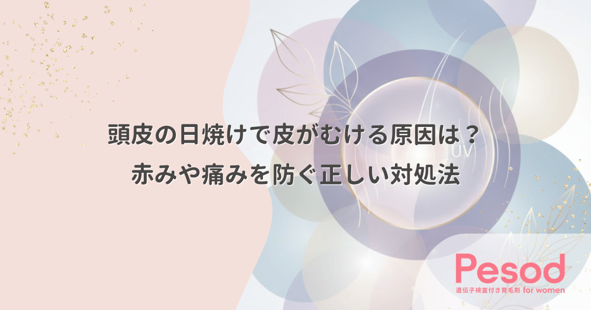 頭皮の日焼けで皮がむける原因は？赤みや痛みを防ぐ正しい対処法