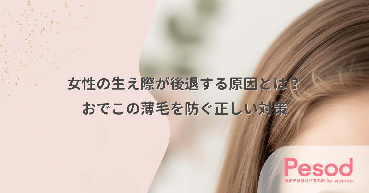 女性の生え際が後退する原因とは?おでこの薄毛を防ぐ正しい対策