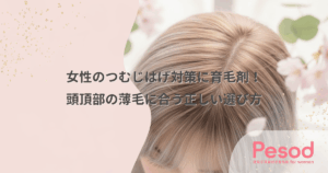 女性のつむじはげ対策に育毛剤！頭頂部の薄毛に合う正しい選び方
