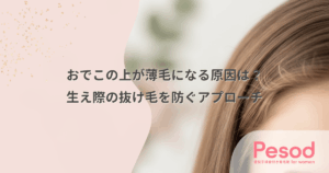 おでこの上が薄毛になる原因は？生え際の抜け毛を防ぐアプローチ