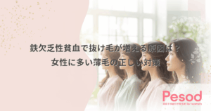 鉄欠乏性貧血で抜け毛が増える原因は？女性に多い薄毛の正しい対策