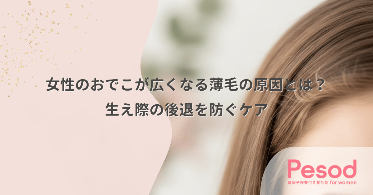 女性のおでこが広くなる薄毛の原因とは？生え際の後退を防ぐケア