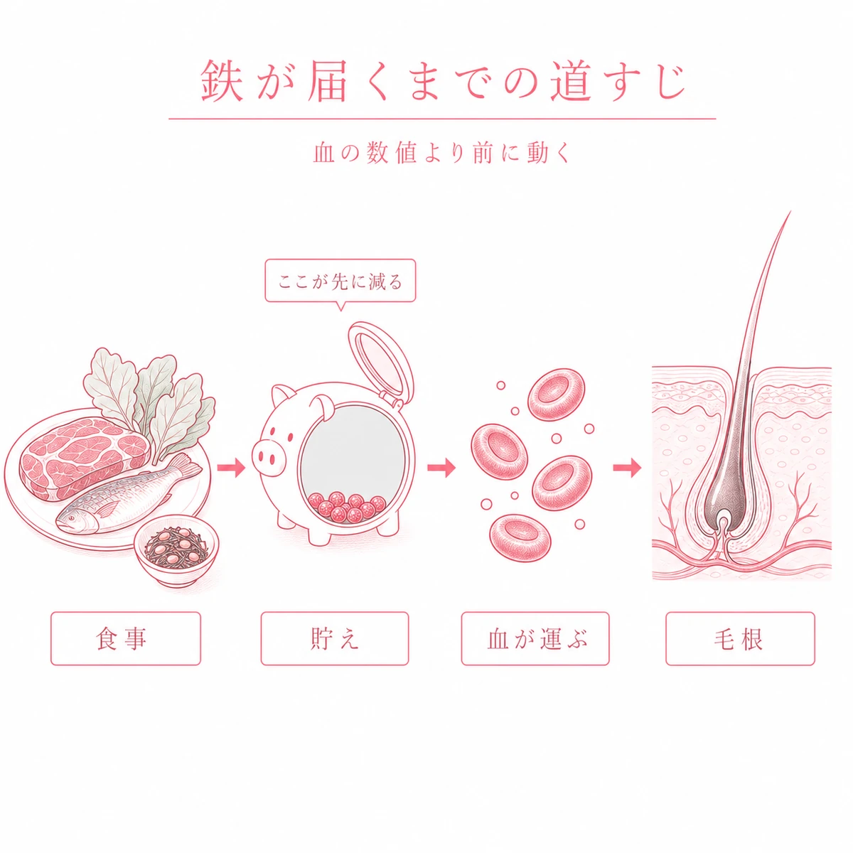 食事からとった鉄が体の貯えを経て血で運ばれ毛根へ届くまでの道すじと貯えが先に減ることを示した図解