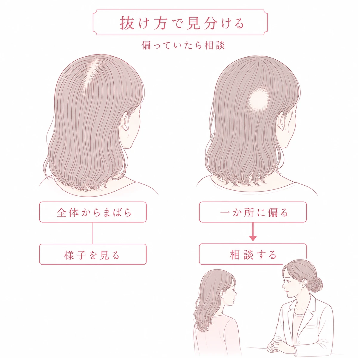 髪全体からまばらに抜ける状態と一か所に偏って抜ける状態を見分けて相談へ進む流れを表した図解