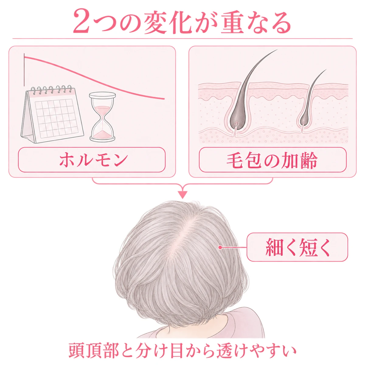 女性ホルモンの減少と毛包の加齢が重なり、頭頂部や分け目の髪が細く短くなる関係図